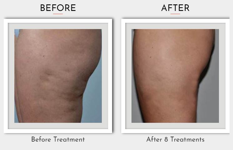 WhatsApp Image 2022-11-15 at 12.35.21 PM (1)