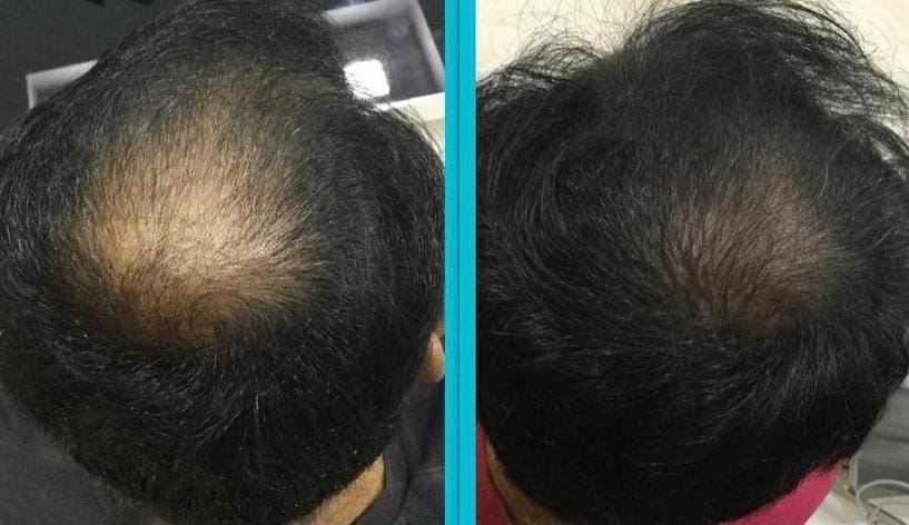 WhatsApp Image 2022-11-15 at 12.45.15 PM